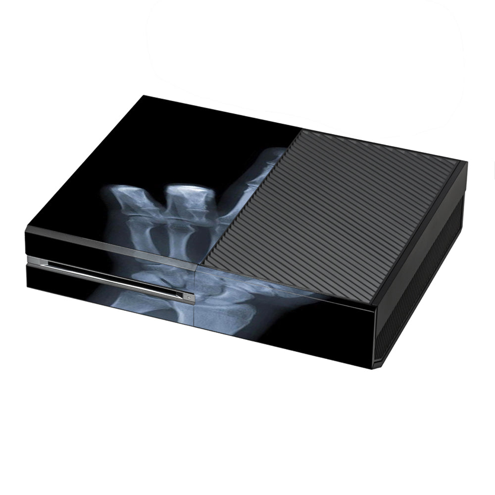  Hand Sign  X-Ray #1  Microsoft Xbox One Skin