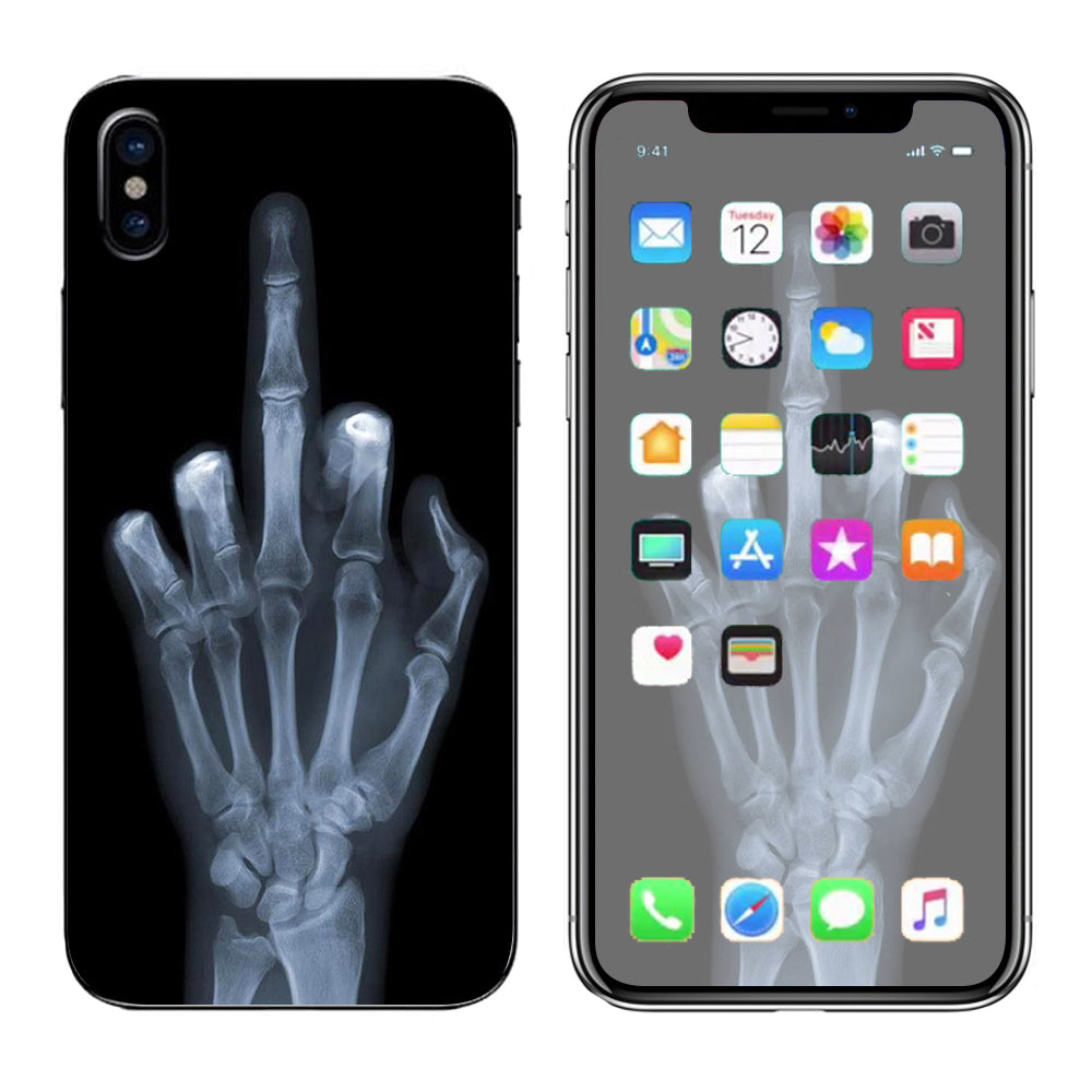  Hand Sign  X-Ray #1  Apple iPhone X Skin